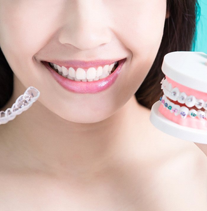 Woman holding Invisalign aligner and traditional braces model