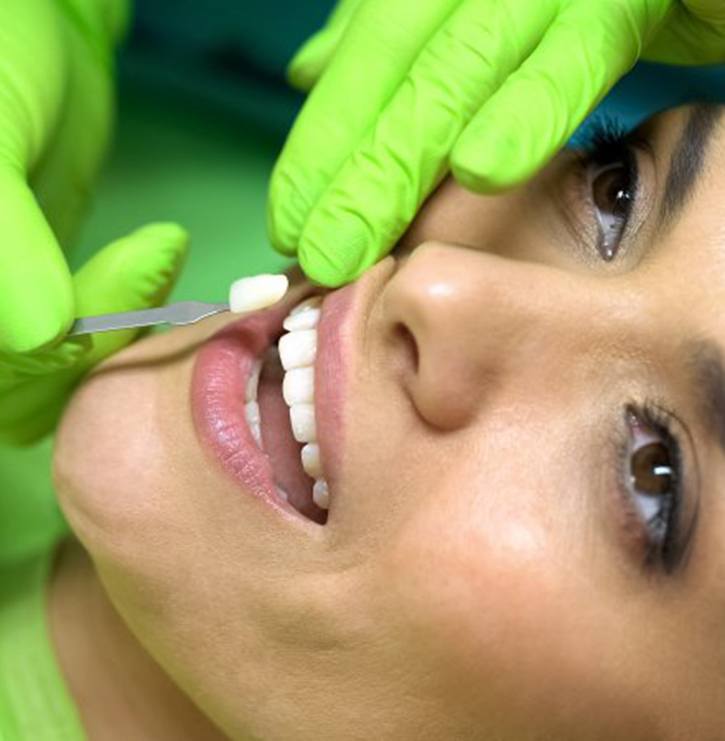dentist placing a veneer on a patient’s tooth 