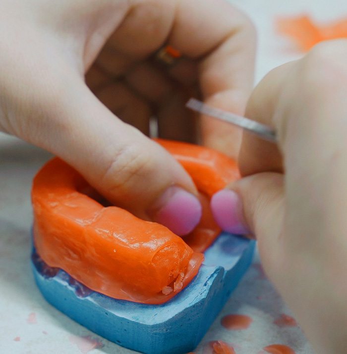 A dental technician creating a wax mold