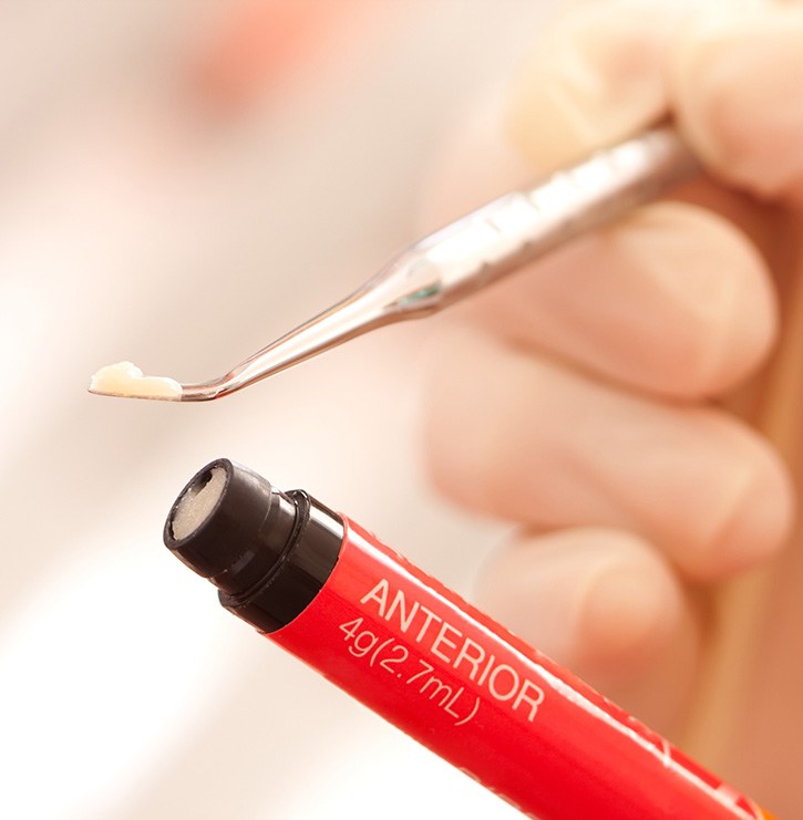 A dentist holding composite resin used for cosmetic dental bonding
