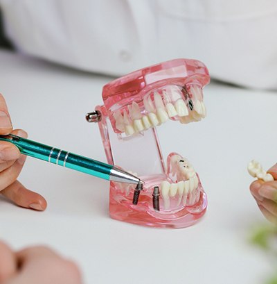 Hands pointing to model implant bridge with green pen