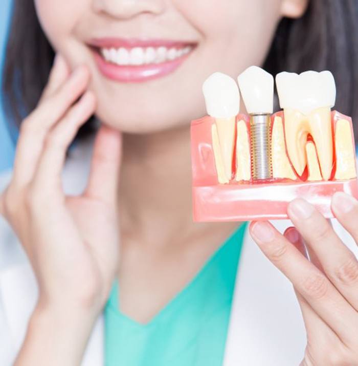 dentist showing how dental implants work in Kansas City