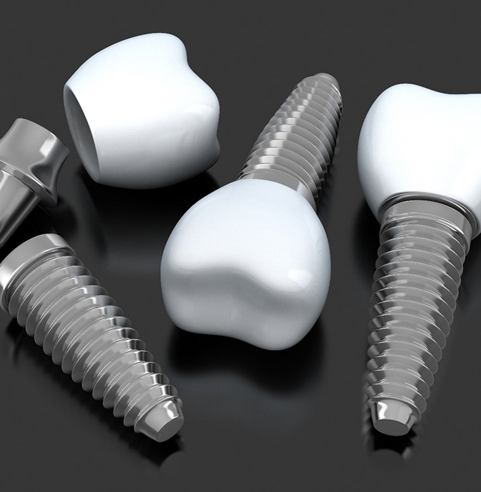 three dental implant posts with abutments and crowns