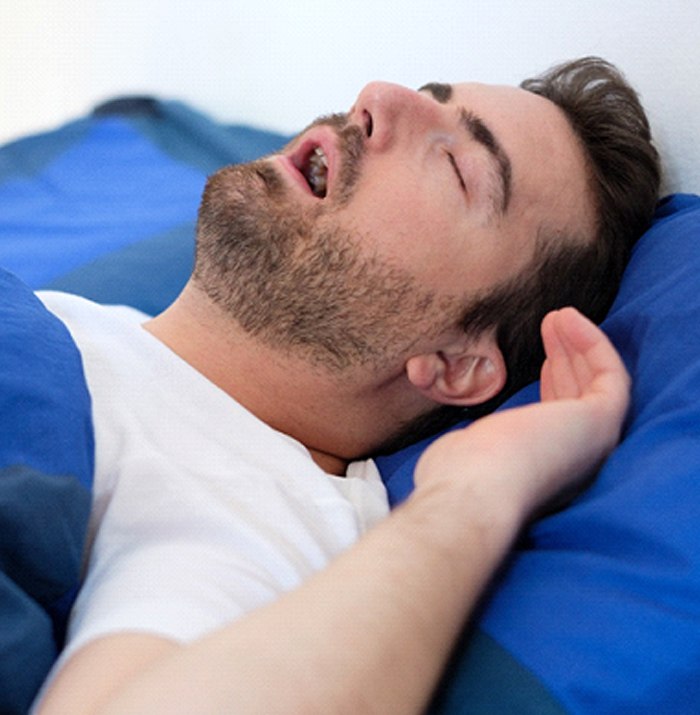 Snoring man in need of sleep apnea therapy in Kansas City
