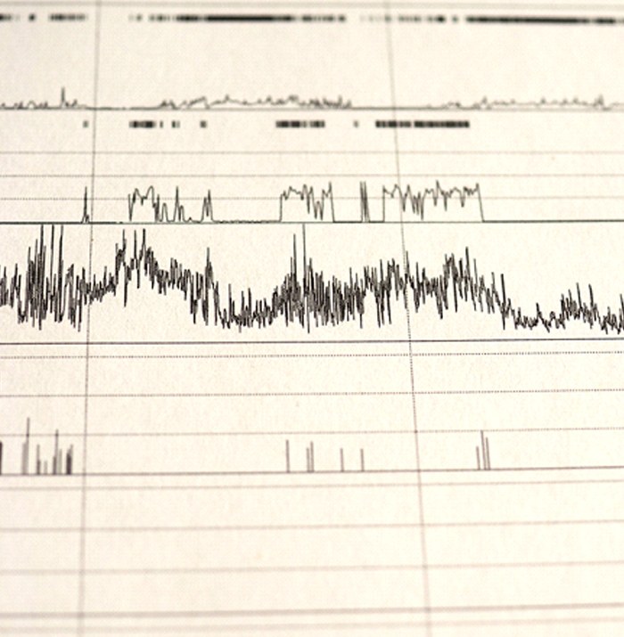 Close-up of polysomnogram results from sleep apnea test