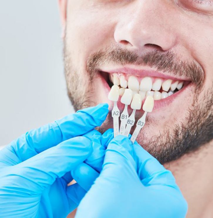 dentist holding veneers up to a patient’s smile 