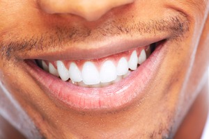 Close-up of a man smiling and showing his teeth